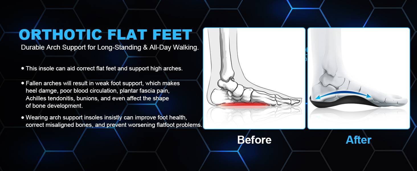 Plantar Fasciitis Insoles Arch Support Inserts Orthotics Shoe Inserts for Men Women,Rapidly Relief Plantar Fasciitis Foot Pain